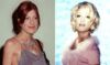 Aktorė Tori Spelling iš „Beverly Hills 90210“ - nebeatpažįstama: kaltos plastinės operacijos?