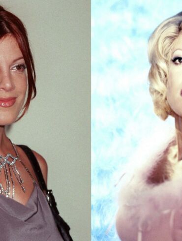 Aktorė Tori Spelling iš „Beverly Hills 90210“ - nebeatpažįstama: kaltos plastinės operacijos?