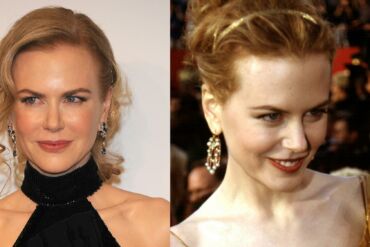 Aktorės Nicoles Kidman išvaizda byloja apie tai