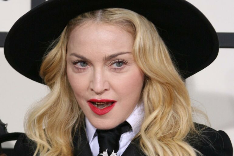 Atlikėja Madonna atsidūrė intensyvios terapijos skyriuje