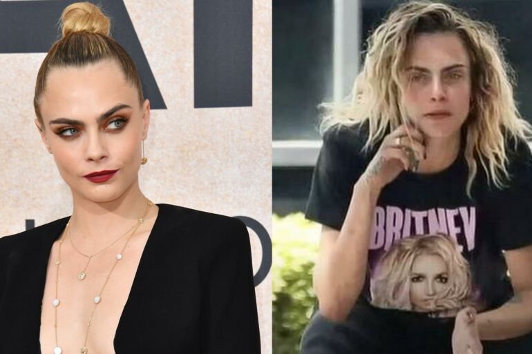 Cara Delevingne savo gerbėjams kelia didžiulį nerimą: itin sulysi manekenė įtariama priklausomybe sunkiems narkotikams