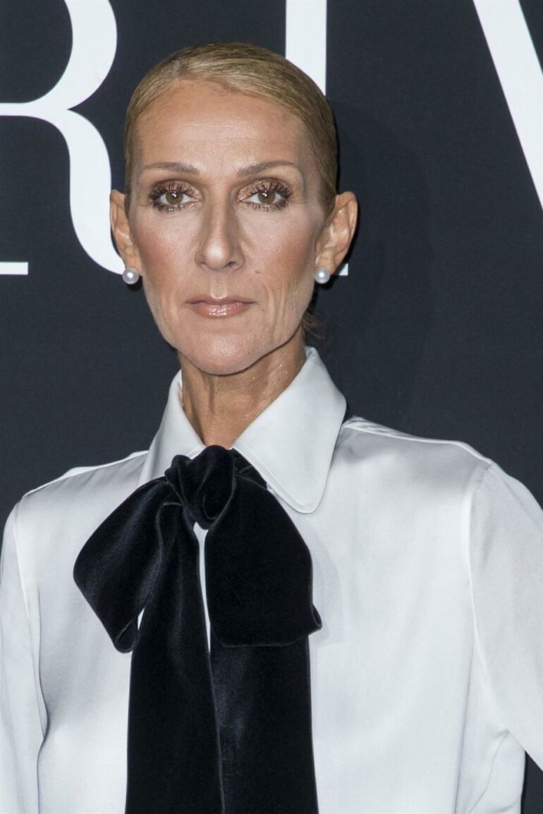 Celine Dion dėl sveikatos būklės atšaukė 2023-2024 metų pasirodymus