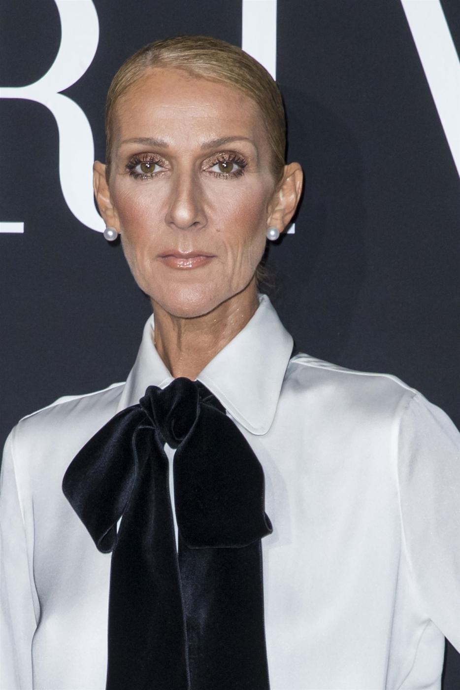 Celine Dion dėl sveikatos būklės atšaukė 2023-2024 metų pasirodymus