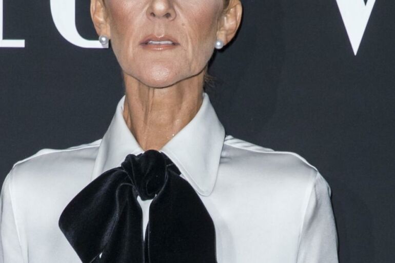 Celine Dion sesuo pasidalijo liūdnomis žiniomis apie atlikėjos sveikatą