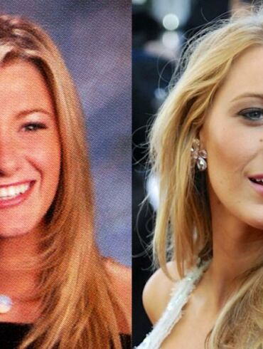 Chirurgų nuopelnas? Kaip keitėsi Blake Lively išvaizda(FOTO)