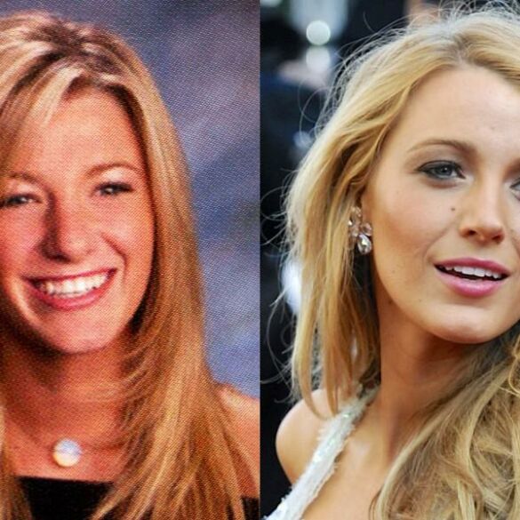 Chirurgų nuopelnas? Kaip keitėsi Blake Lively išvaizda(FOTO)