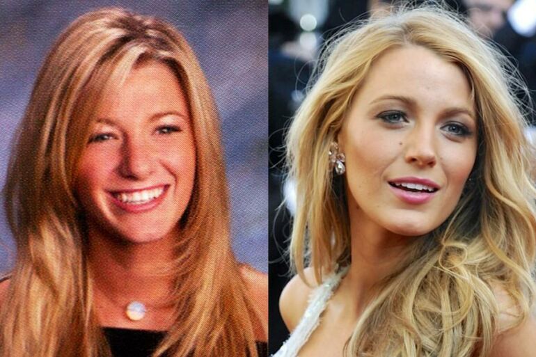 Chirurgų nuopelnas? Kaip keitėsi Blake Lively išvaizda(FOTO)
