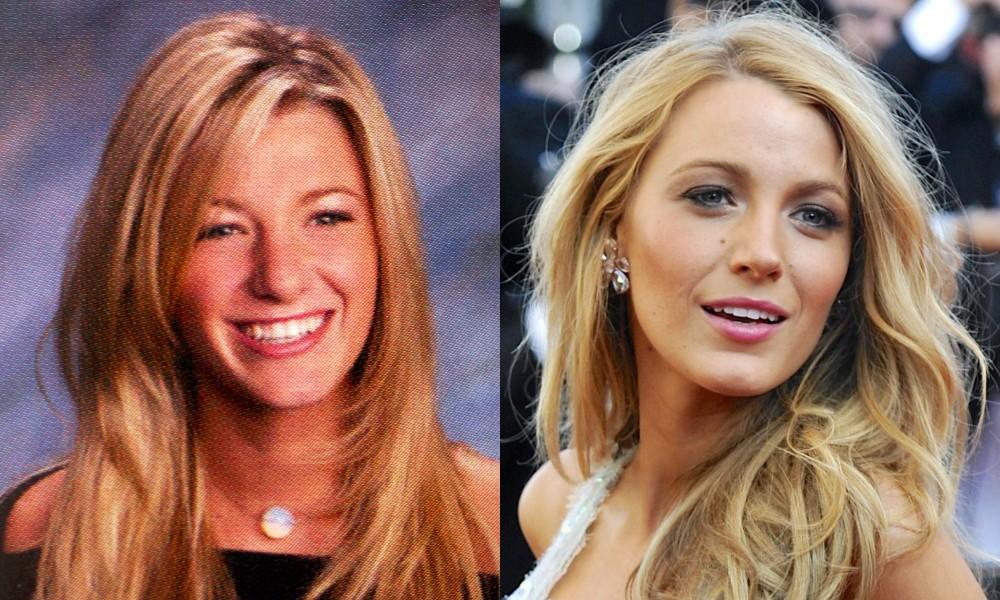 Chirurgų nuopelnas? Kaip keitėsi Blake Lively išvaizda(FOTO)