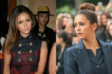 Drąsa: Nina Dobrev mados savaitėje neslėpė sužeistos kojos(FOTO)