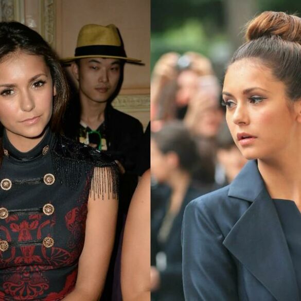 Drąsa: Nina Dobrev mados savaitėje neslėpė sužeistos kojos(FOTO)