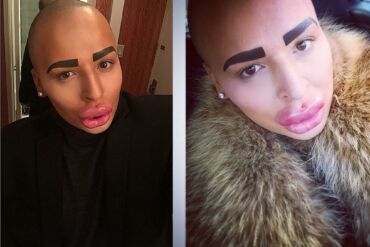 Grožio kaina: norėdamas supanašėti su Kim Kardashian