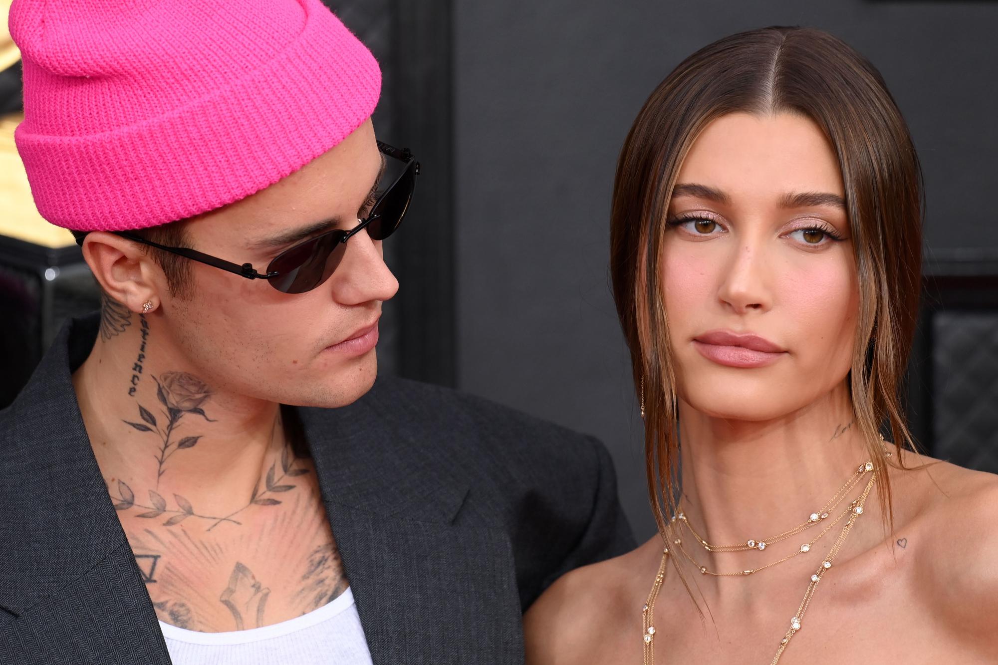 Justin Bieber žmona Hailey Bieber susidūrė su labai rimtu sveikatos sutrikimu: „Tai tikrai buvo baisiausia mano gyvenimo akimirka“