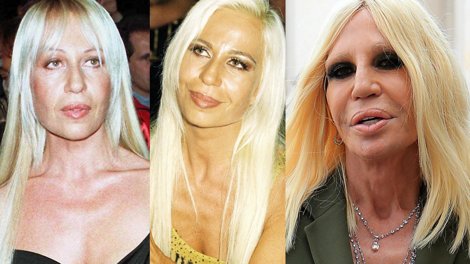 Kaip Donatella Versace iš natūralios gražuolės tapo visų aptarinėjama įžymybe (FOTO)