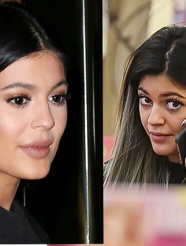 Kas nutiko 17-metės Kylie Jenner veidui?(FOTO)