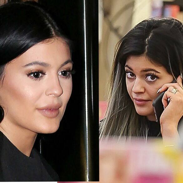 Kas nutiko 17-metės Kylie Jenner veidui?(FOTO)