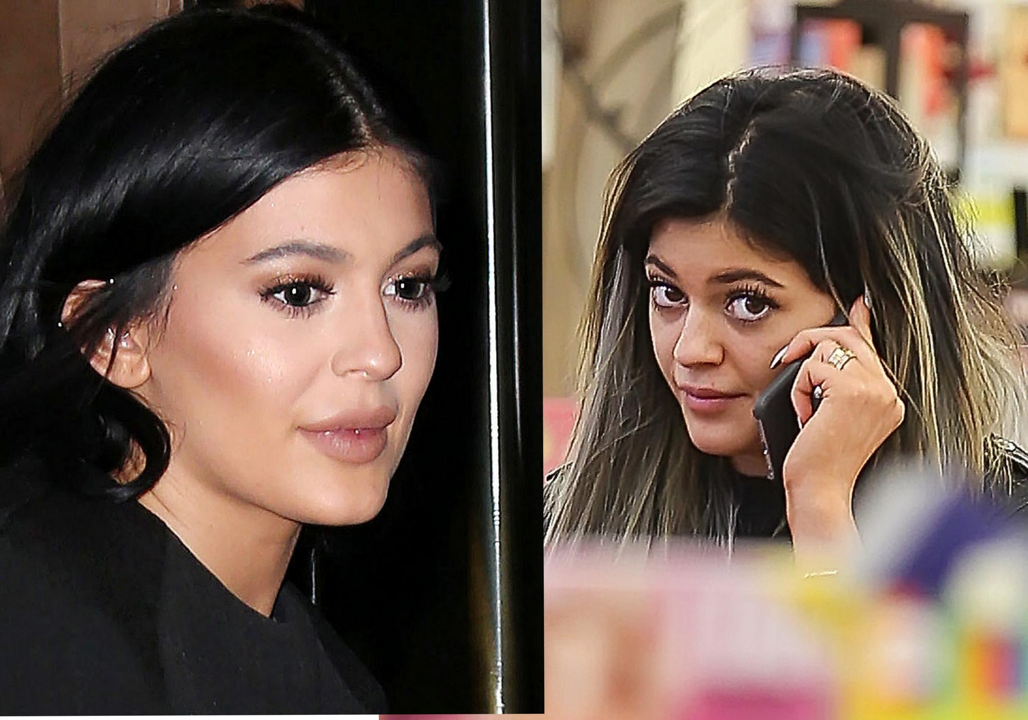 Kas nutiko 17-metės Kylie Jenner veidui?(FOTO)