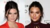 Kendall Jenner prisipažino: ją kankino baisios odos problemos (FOTO paauglystėje)