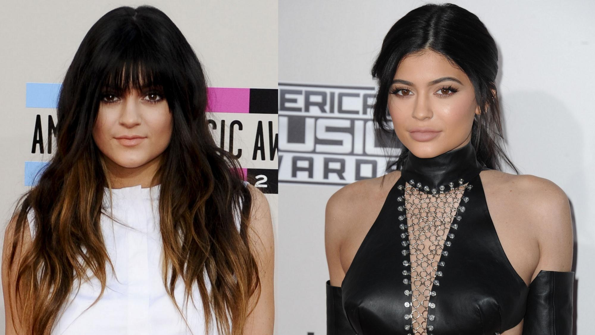 Kylie Jenner metamorfozės: ar išeis atpažinti?! (FOTO)