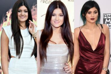 Kylie Jenner pokyčiai: ar tai – visagalis makiažas?