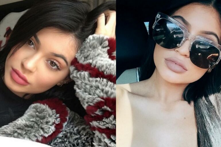 Kylie Jenner rodo pavyzdį