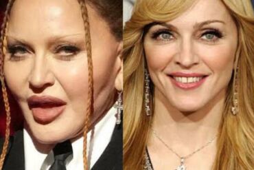 Madonna gerbėjai stebėjosi popmuzikos karalienės „keistai atrodančiu veidu“ „Grammy“ ceremonijoje