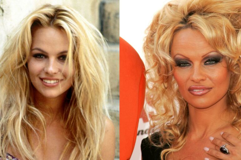 Pamela Anderson paauglystėje: stebėtina