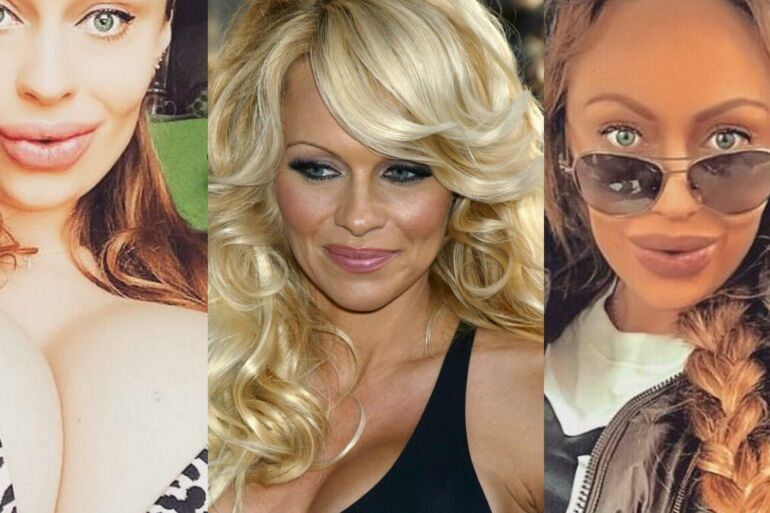 Pamelos Anderson antrininke save laikanti rusaitė: kas per daug