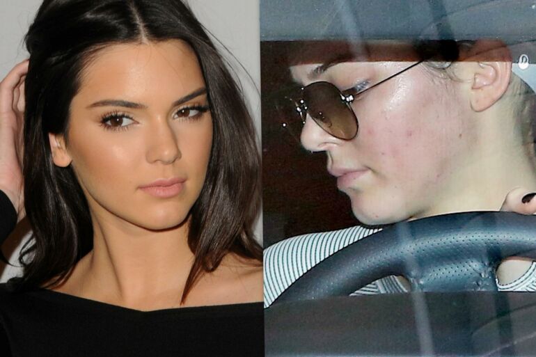 Paparacų įamžinta viršelių mergina Kendall Jenner – spuoguota oda ir permatomomis kelnėmis(FOTO)