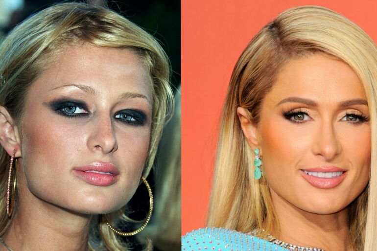 Paris Hilton atvėrė širdį: prabilo apie internatinėje mokykloje patirtą seksualinę prievartą