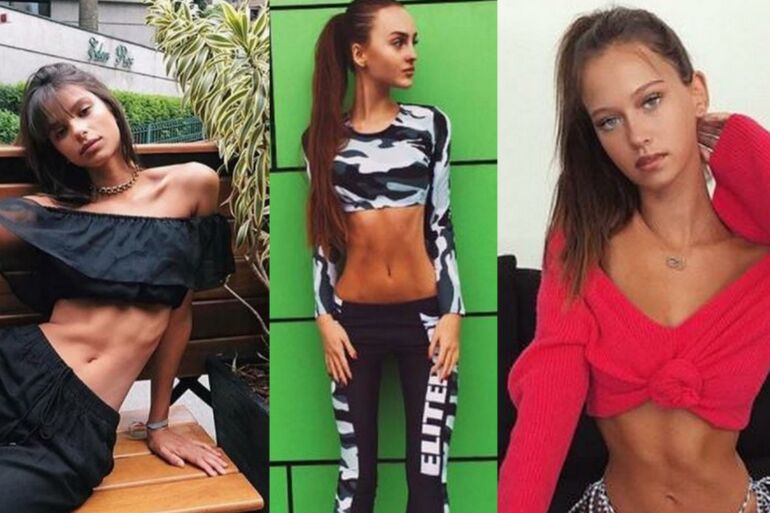 Tai siaubinga! Po gražiomis merginų „Instagram“ nuotraukomis slypi karti realybė (FOTO)