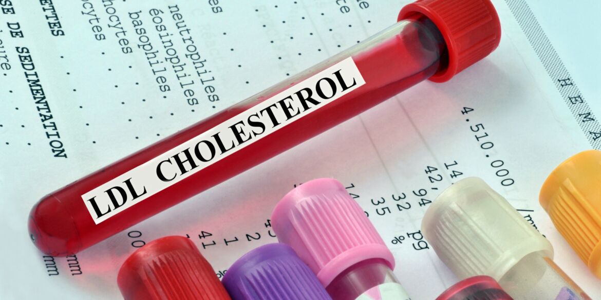 cholesterolio tyrimai