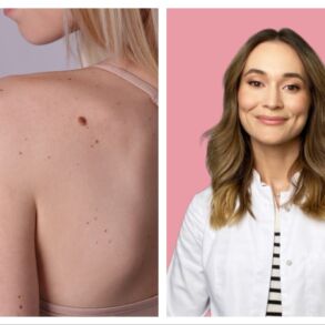 Dermatologė-trichologė Gintarė Ulianskaitė.