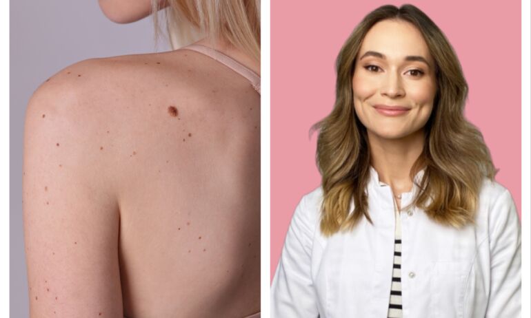 Dermatologė-trichologė Gintarė Ulianskaitė.