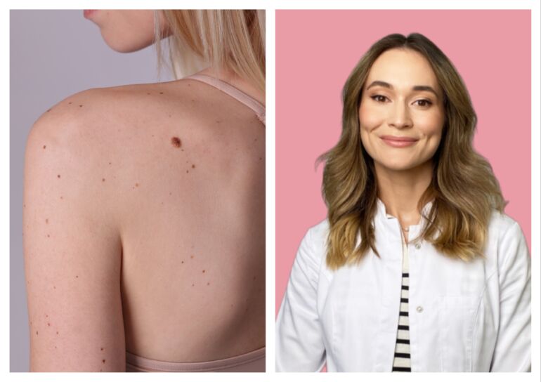 Dermatologė-trichologė Gintarė Ulianskaitė.